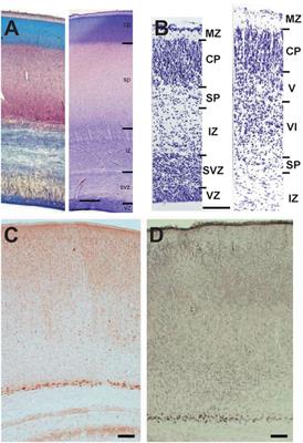 The Superior Function of the Subplate in Early Neocortical Development